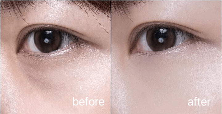 眼霜到底该买哪个？两大人气款PK你选谁OG视讯雅诗兰黛小棕瓶眼霜和兰蔻发光(图3)